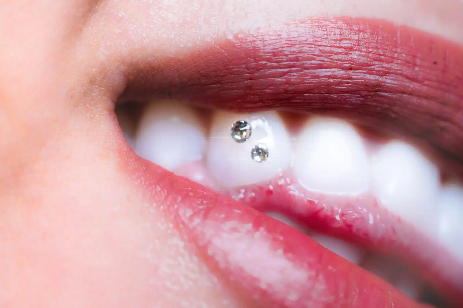 Zdjęcie biżuterii nazębnej, kolczyków tooth gems.