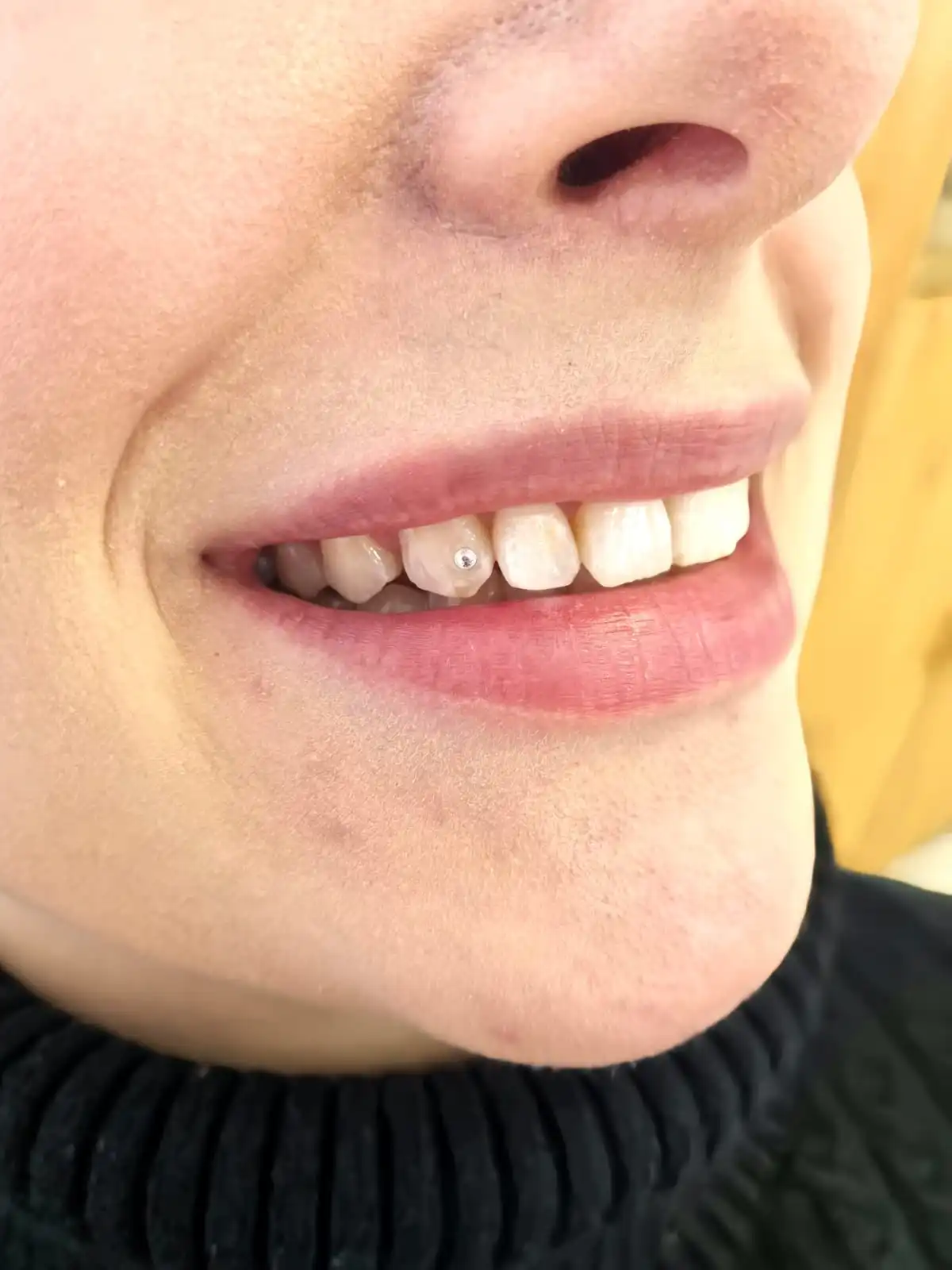Zdjęcie biżuterii nazębnej, kolczyków tooth gems.